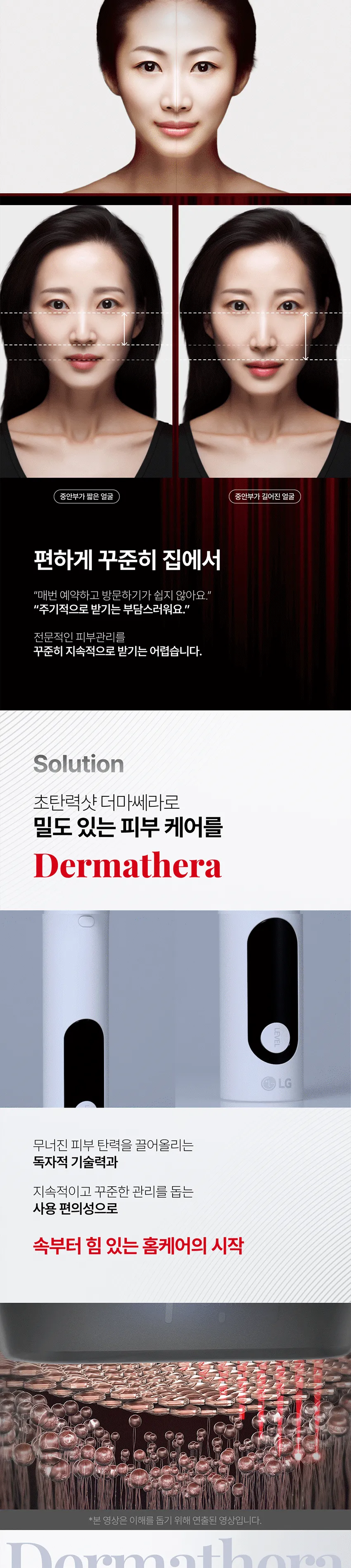 LG전자 프라엘 더마쎄라 얼굴라인케어 기기 상세정보 2